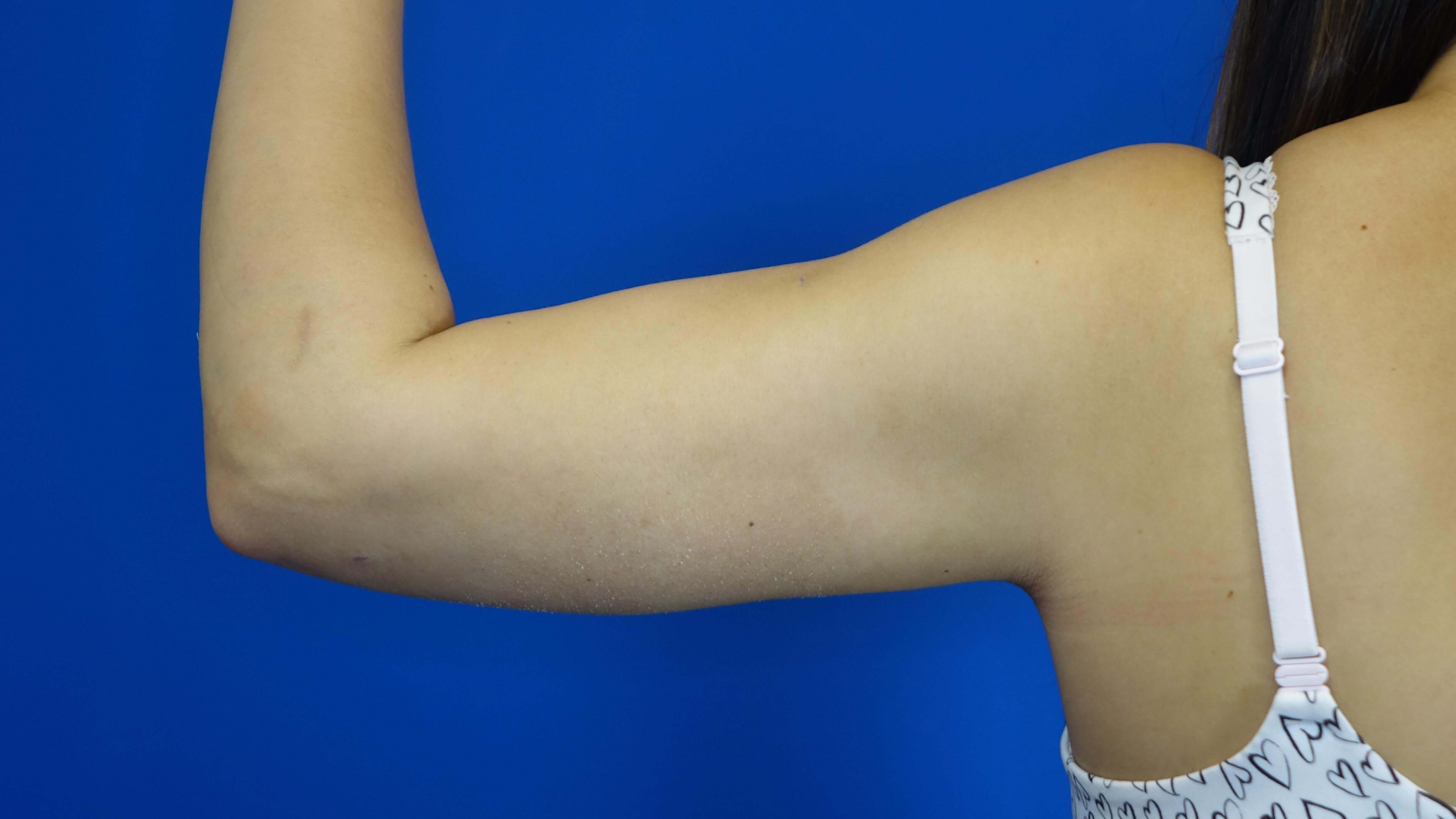 Postop view of 27 year-old's a